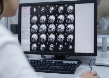 Hasta el 45% del riesgo de demencia puede prevenirse: OMS