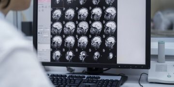 Hasta el 45% del riesgo de demencia puede prevenirse: OMS