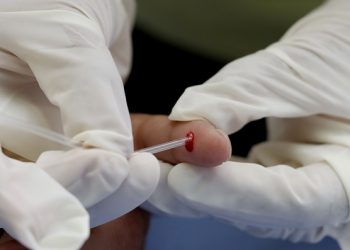 Refuerza IMSS Puebla prevención de hepatitis B y C